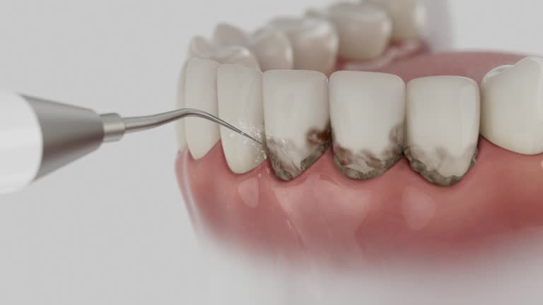 Reliable Wisdom Tooth Removal contractor in Ashland County County, OH by Dentist Open Now
